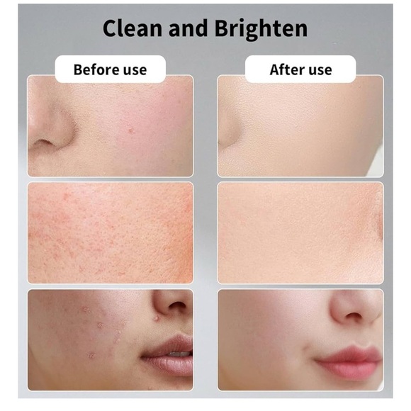 Resurfacing Pad Glycolic Acid Pads for Face: Facial Exfoliating Cleansing Peel - Picture 2 of 5